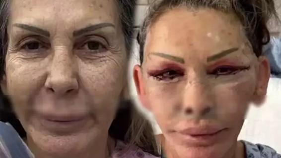 Petek Dinçöz'ün annesi son haliyle şaşırttı!